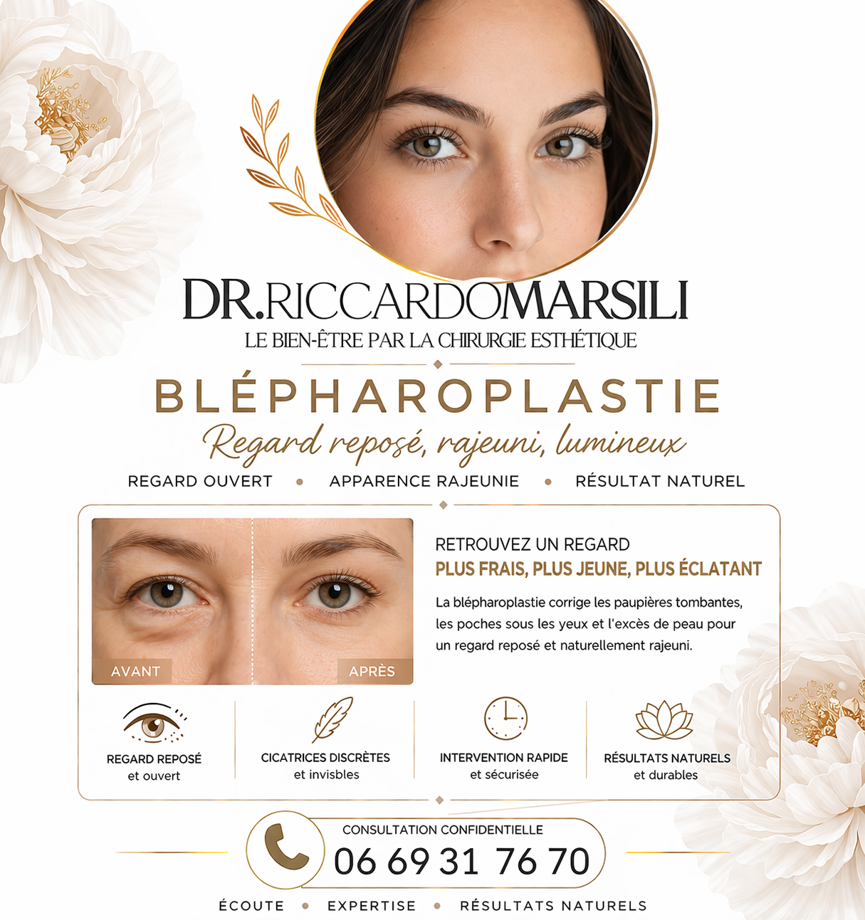 Blépharoplastie paupières Paris 16