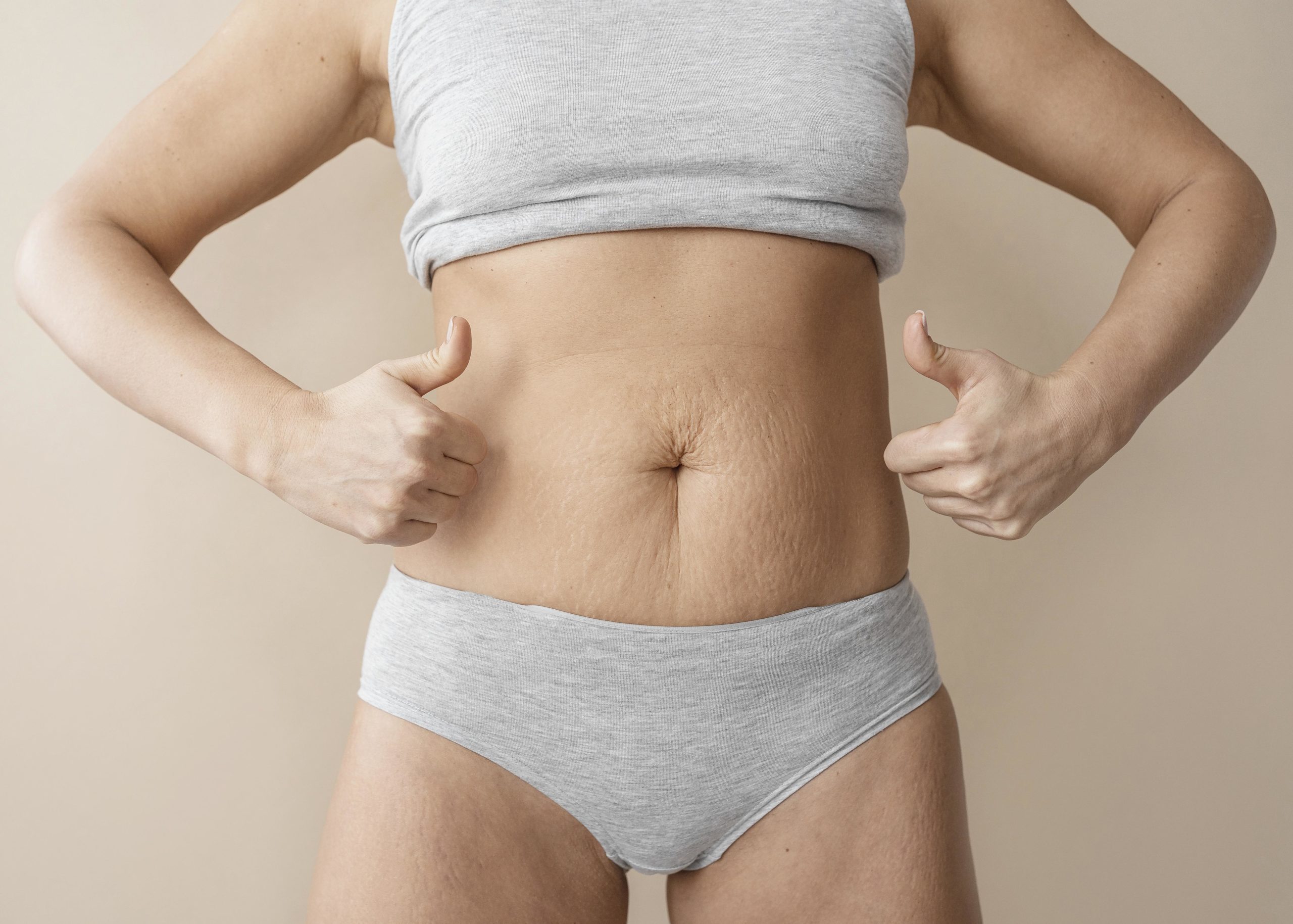 Histoire de l’abdominoplastie en France