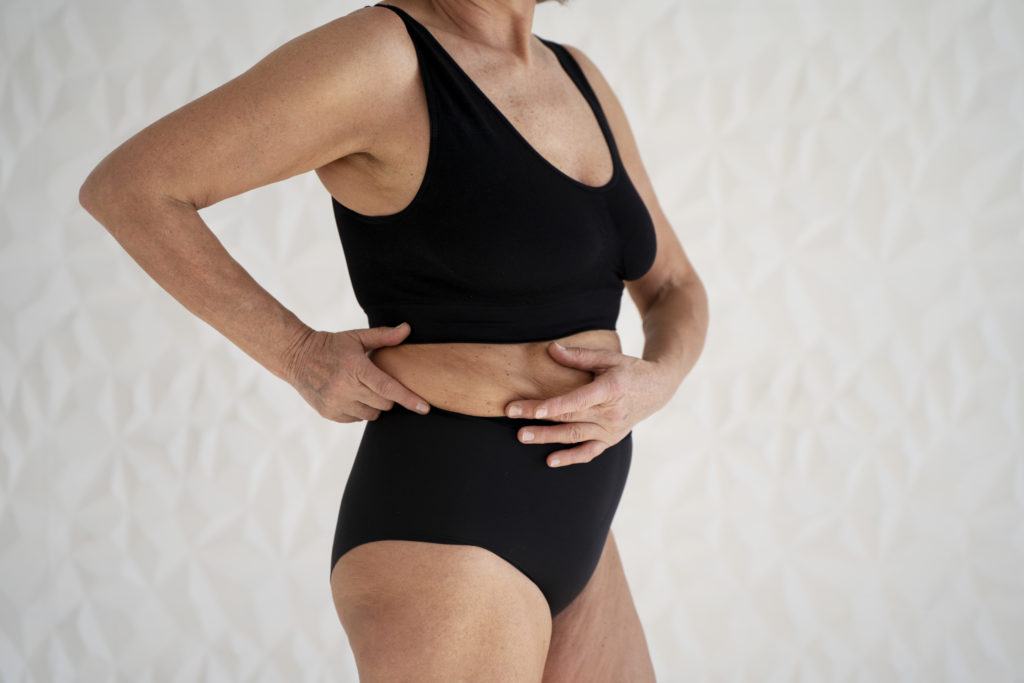 Sport après abdominoplastie